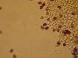 Panaeolus bisporus image