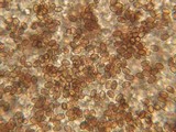 Psathyrella spadiceogrisea image