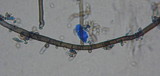 Aureobasidium pullulans image