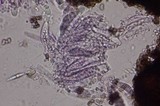 Colletotrichum coccodes image