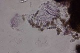 Colletotrichum coccodes image
