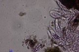 Colletotrichum coccodes image