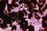 Colletotrichum coccodes image