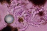 Colletotrichum coccodes image