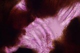 Colletotrichum coccodes image