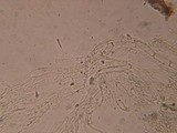 Hemimycena mauretanica image