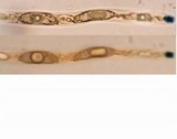 Xylaria cornu-damae image