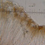 Lecidea berengeriana image
