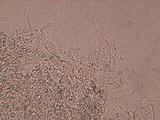 Entoloma cephalotrichum image