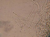 Entoloma cephalotrichum image