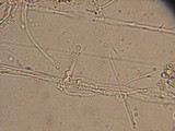 Entoloma cephalotrichum image