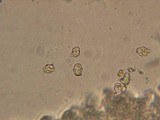 Entoloma cephalotrichum image