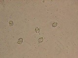 Entoloma cephalotrichum image
