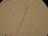 Peziza varia image