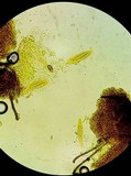 Thaxteriella pezizula image