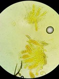 Thaxteriella pezizula image