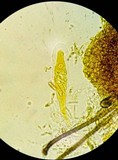 Thaxteriella pezizula image