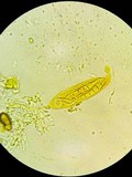 Thaxteriella pezizula image