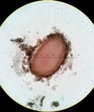 Coryne dubia image