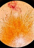 Coryne dubia image