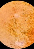 Coryne dubia image