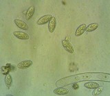 Trichophaea hybrida image