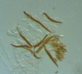 Trichophaea hybrida image