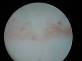 Sebacina sparassoidea image