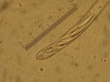 Hymenoscyphus fructigenus image