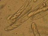 Hymenoscyphus fructigenus image
