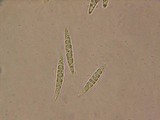 Herpotrichia macrotricha image