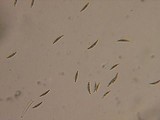 Herpotrichia macrotricha image
