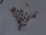 Melanohalea exasperata image