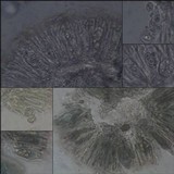 Melanohalea exasperata image