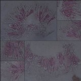 Melanohalea exasperata image