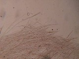 Pluteus petasatus image