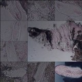Pertusaria heterochroa image