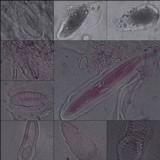 Pertusaria heterochroa image