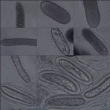 Pertusaria heterochroa image
