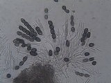 Sphinctrina tubiformis image