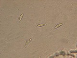Hypomyces lateritius image