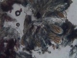 Arthonia cinnabarina image