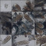 Arthonia cinnabarina image