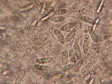Coccomyces gaultheriae image