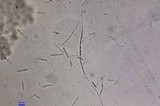 Tolypocladium ophioglossoides image