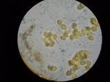 Oudemansiella furfuracea image