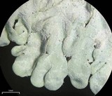 Pyxine cocoës image