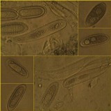 Pertusaria pustulata image