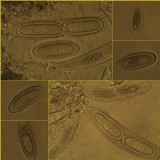 Pertusaria pustulata image