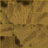 Phlyctis agelaea image